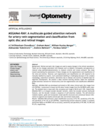 MSGANet-RAV: A multiscale guided attention network for artery-vein segmentation and classification from optic disc and retinal images