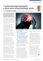 Cerebral amyloid angiopathy: a silent cause of haemorrhagic stroke